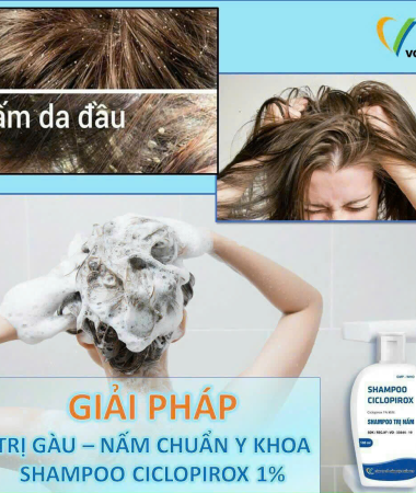 Nguyên nhân da đầu bị gàu